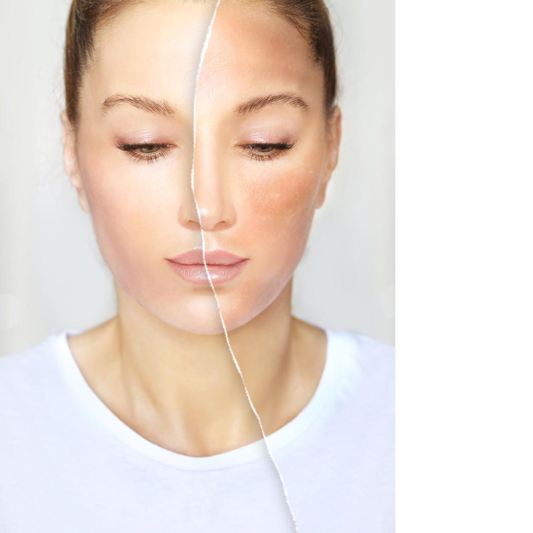 ¿Cuándo empezar a cuidar la piel? Guía completa según cada etapa de la vida