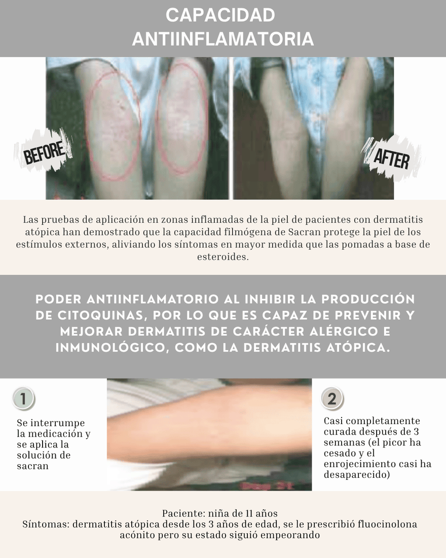 ANTIINFLAMATORIO